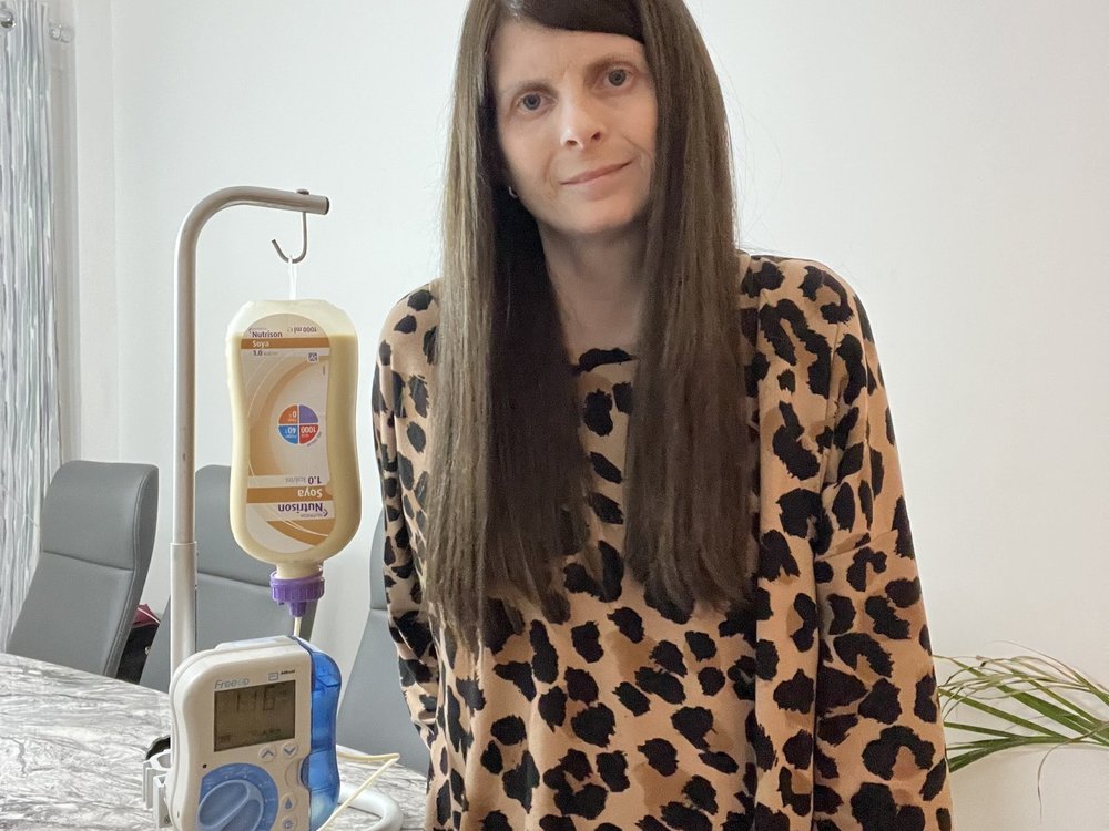 A lady standing next to a table with feeding tube apparatus on