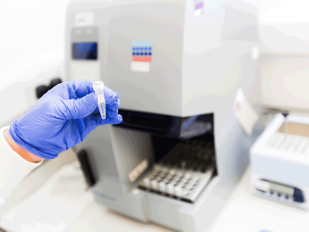 A hand in a blue medical glove holding a micropipette tube. Behind the hand is a medical testing device